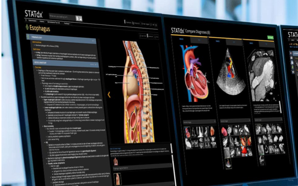 STATdx – subskrypcja dla aktywnych członków PLTR
