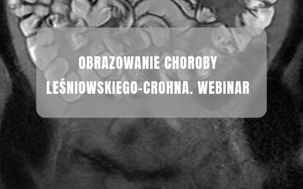 Zapraszamy na webinar